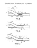 STENTED VASCULAR GRAFT diagram and image