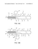 STENTED VASCULAR GRAFT diagram and image