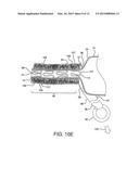 STENTED VASCULAR GRAFT diagram and image