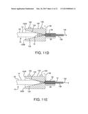 STENTED VASCULAR GRAFT diagram and image