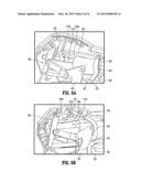 MULTI-FUNCTION SURGICAL INSTRUMENTS diagram and image