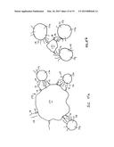 DIMENSIONALLY CONTROLLED  ENGINEERED POLYMER BUBBLE  FOR FLOTATION     SEPARATION diagram and image