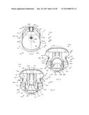 Dispensing System with Bracket diagram and image