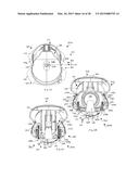 Dispensing System with Bracket diagram and image