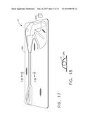 SURGICAL INSTRUMENT WITH WIRELESS COMMUNICATION BETWEEN CONTROL UNIT AND     REMOTE SENSOR diagram and image