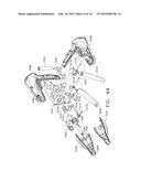 SURGICAL INSTRUMENT WITH WIRELESS COMMUNICATION BETWEEN CONTROL UNIT AND     REMOTE SENSOR diagram and image