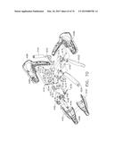 SURGICAL INSTRUMENT WITH WIRELESS COMMUNICATION BETWEEN CONTROL UNIT AND     REMOTE SENSOR diagram and image