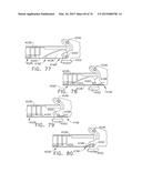 SURGICAL INSTRUMENT WITH WIRELESS COMMUNICATION BETWEEN CONTROL UNIT AND     REMOTE SENSOR diagram and image