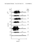 SYSTEMS, ARTICLES, AND METHODS FOR GESTURE IDENTIFICATION IN WEARABLE     ELECTROMYOGRAPHY DEVICES diagram and image