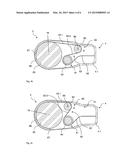 Endoscope Or Exoscope diagram and image