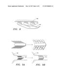 Open Ear Canal Hearing Aid diagram and image