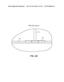 Micro-Tube Particles for Microfluidic Assays and Methods of Manufacture diagram and image