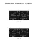 SCREENING METHOD FOR THE DETECTION OF CLOSTRIDIUM DIFFICILE diagram and image