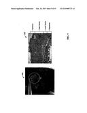 Injectable Gelling Material diagram and image