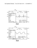 Vital Signs Monitor diagram and image