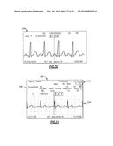 Vital Signs Monitor diagram and image