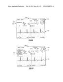 Vital Signs Monitor diagram and image