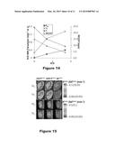 METHOD AND APPARATUS USING MAGNETIC RESONANCE IMAGING FOR TISSUE     PHENOTYPING AND MONITORING diagram and image