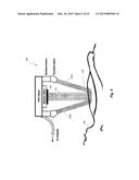 SYSTEMS AND METHODS FOR OPTICALLY GUIDED PLACEMENT AND MONITORING OF     MEDICAL IMPLANTS diagram and image