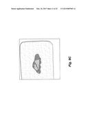 SYSTEMS AND METHODS FOR OPTICALLY GUIDED PLACEMENT AND MONITORING OF     MEDICAL IMPLANTS diagram and image