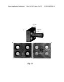 SYSTEMS AND METHODS FOR OPTICALLY GUIDED PLACEMENT AND MONITORING OF     MEDICAL IMPLANTS diagram and image