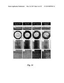 SYSTEMS AND METHODS FOR OPTICALLY GUIDED PLACEMENT AND MONITORING OF     MEDICAL IMPLANTS diagram and image