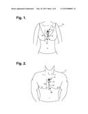 Computer-Implemented System And Method For Providing A Personal Mobile     Device-Triggered Medical Intervention diagram and image