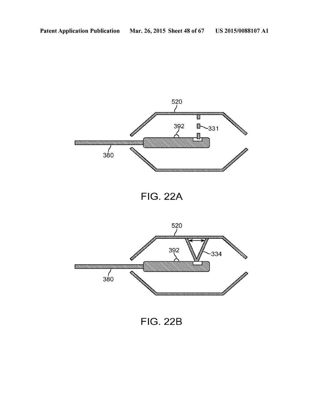 AUTOMATED IMAGE-GUIDED TISSUE RESECTION AND TREATMENT - diagram, schematic, and image 49