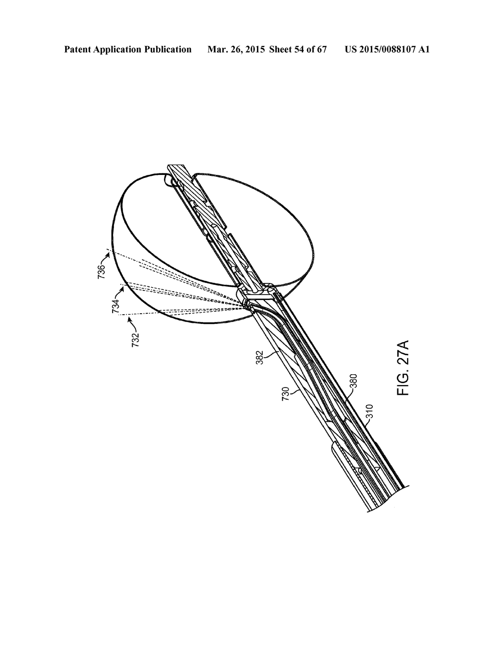 AUTOMATED IMAGE-GUIDED TISSUE RESECTION AND TREATMENT - diagram, schematic, and image 55