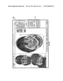 PROBE DRIVER diagram and image