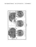 PROBE DRIVER diagram and image