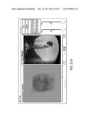 AUTOMATED IMAGE-GUIDED TISSUE RESECTION AND TREATMENT diagram and image