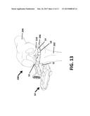 SPACER BLOCK diagram and image