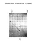 METHOD FOR ALIGNING AN ACETABULAR CUP diagram and image