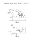 METHOD FOR ALIGNING AN ACETABULAR CUP diagram and image