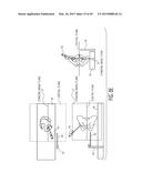 METHOD FOR ALIGNING AN ACETABULAR CUP diagram and image