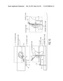 METHOD FOR ALIGNING AN ACETABULAR CUP diagram and image