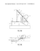 METHOD FOR ALIGNING AN ACETABULAR CUP diagram and image