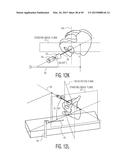 METHOD FOR ALIGNING AN ACETABULAR CUP diagram and image