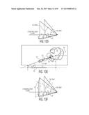 METHOD FOR ALIGNING AN ACETABULAR CUP diagram and image