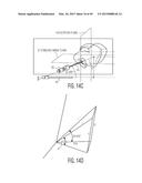 METHOD FOR ALIGNING AN ACETABULAR CUP diagram and image