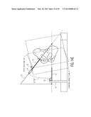 METHOD FOR ALIGNING AN ACETABULAR CUP diagram and image