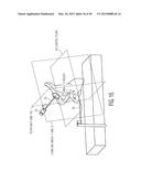 METHOD FOR ALIGNING AN ACETABULAR CUP diagram and image