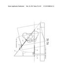 METHOD FOR ALIGNING AN ACETABULAR CUP diagram and image