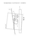 METHOD FOR ALIGNING AN ACETABULAR CUP diagram and image