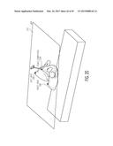 METHOD FOR ALIGNING AN ACETABULAR CUP diagram and image