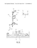 METHOD FOR ALIGNING AN ACETABULAR CUP diagram and image