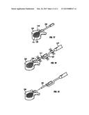 DEVICES FOR DELIVERING BONE FILLER MATERIAL AND ASSOCIATED METHODS OF USE diagram and image