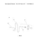 METHODS, DEVICES AND SYSTEMS FOR APPROXIMATION AND FASTENING OF SOFT     TISSUE diagram and image