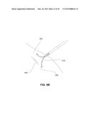 METHODS, DEVICES AND SYSTEMS FOR APPROXIMATION AND FASTENING OF SOFT     TISSUE diagram and image